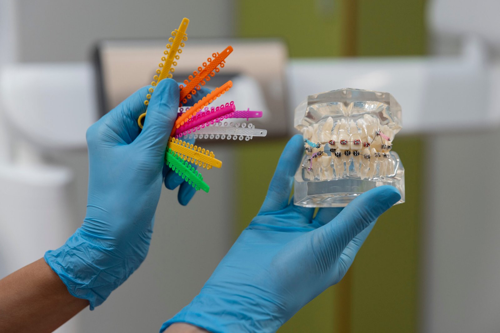 elstics and braces