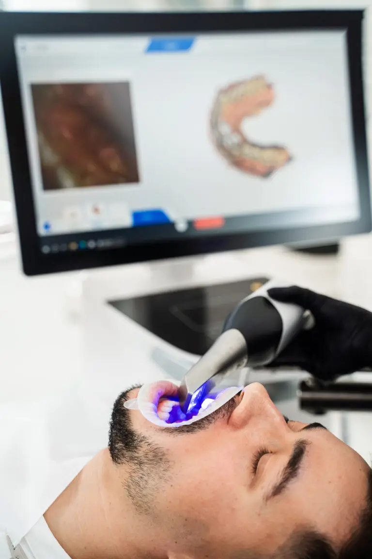 scan intra-oral pour impressions numériques et mise en place
